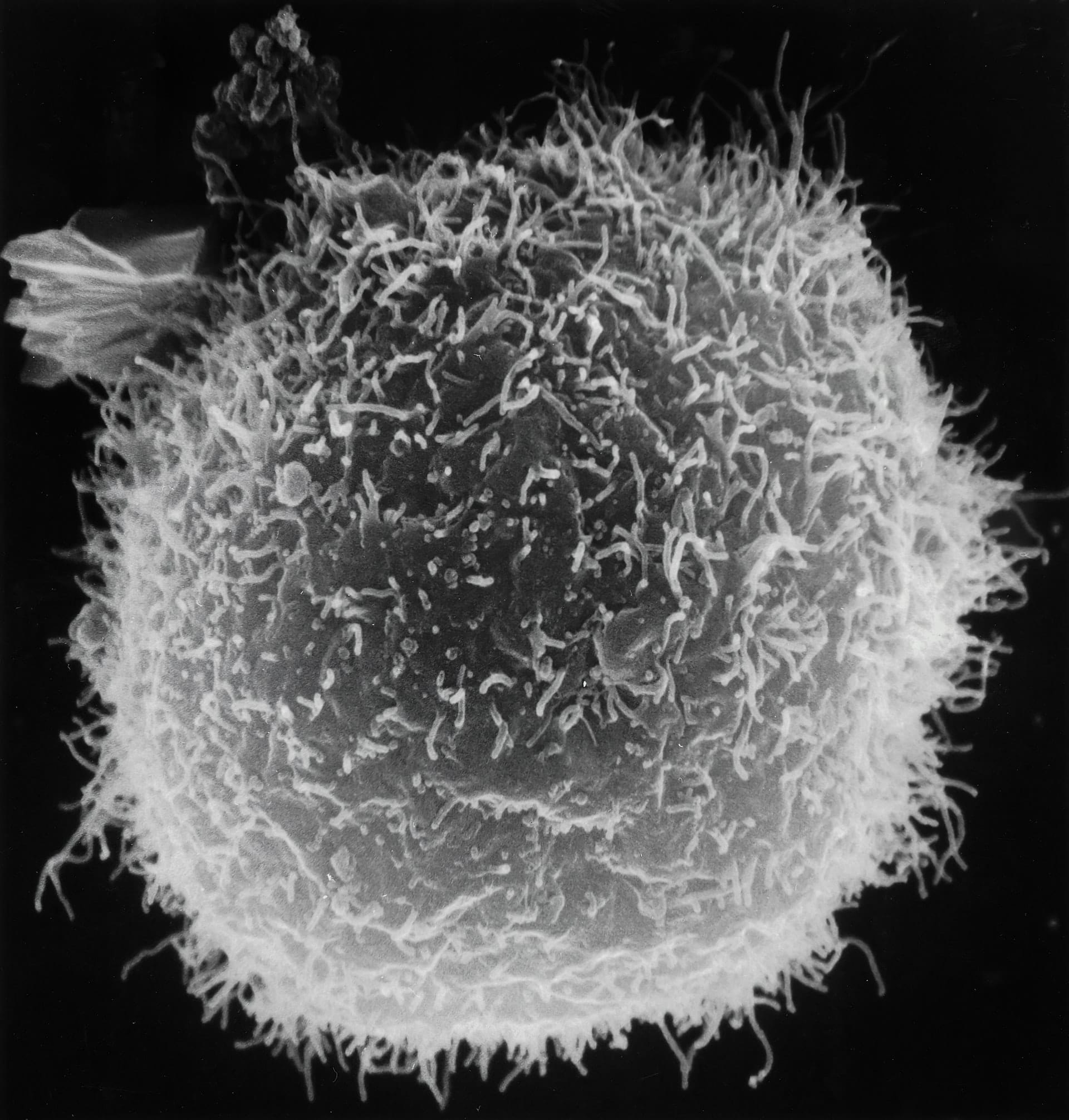globule_blanc